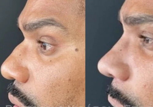 Cantor Naldo relata problema no nariz ( imagem: Instagram)