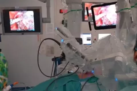 Conheça o robô que realiza transplante de pulmão