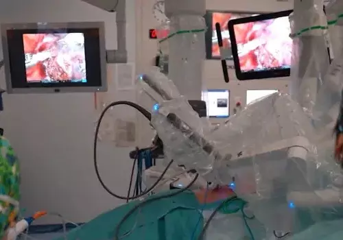 Conheça o robô que realiza transplante de pulmão